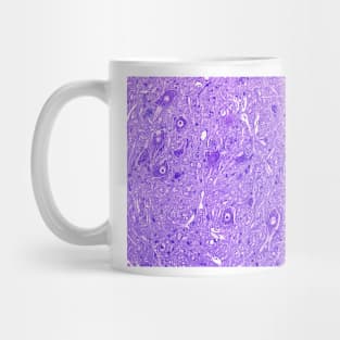 Motor neurons, light micrograph (C024/0081) Mug